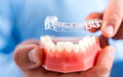 Tips for Invisalign braces