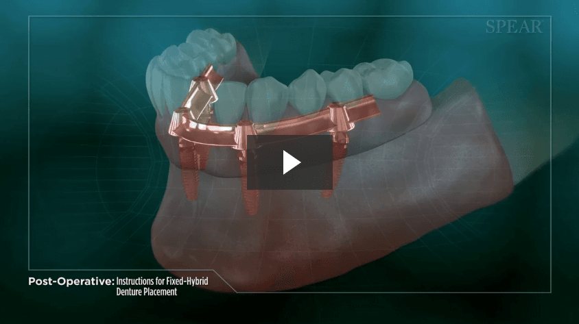 Post-Operative Instructions for Fixed-Hybrid Denture Placement