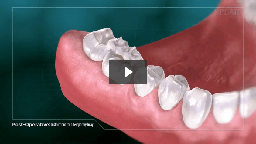 Post-Operative Instructions for a Temporary Inlay