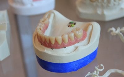What are Cavities?