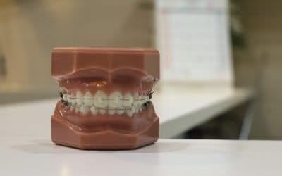 Types of Cosmetic Dental Treatments Explained