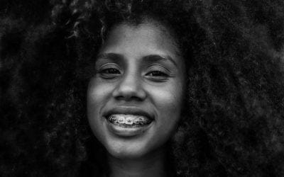 Importance of Braces