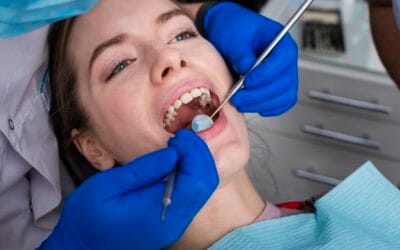 Gum Grafting: What You Need To Know