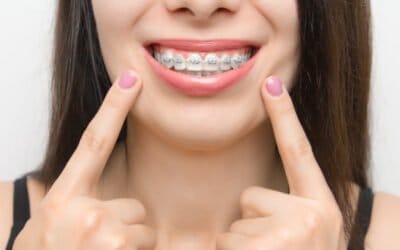 Orthodontics Could Be in Your Smile Makeover Plan