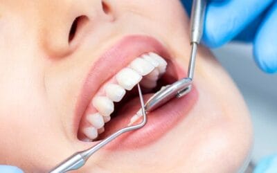 Cosmetic Dentistry FAQ