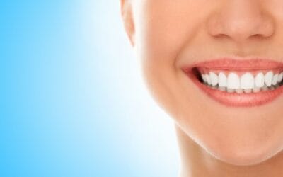 Why Is Your Smile Gummy? Here Are 4 Possibilities
