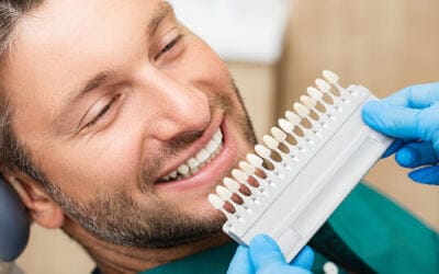 Most Commonly Asked Questions about Dental Veneers