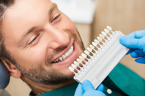 Most Commonly Asked Questions about Dental Veneers