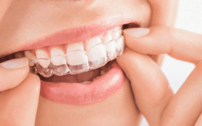 Orthodontics for Children’s Teeth Alignment