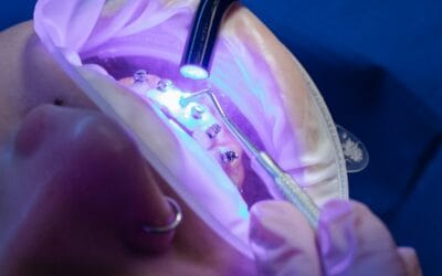 What Can Cause Tooth Discoloration?