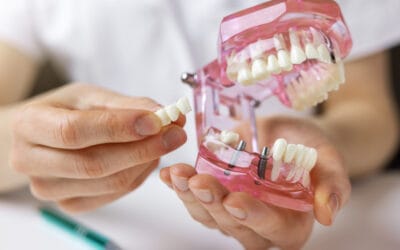 Dental Implants in Oshawa: Cost, Process & Who Qualifies