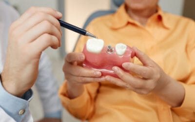 How Long Do Dental Implants Last? Care & Maintenance Guide