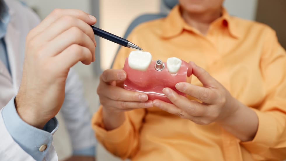 How Long Do Dental Implants Last? Care & Maintenance Guide